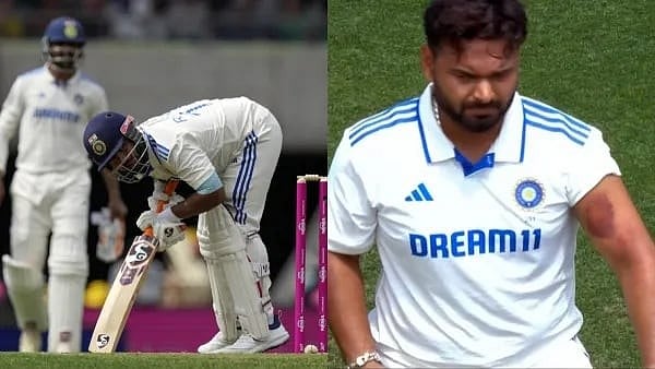 Rishabh Pant after taking the body blows during his innings in Sydney