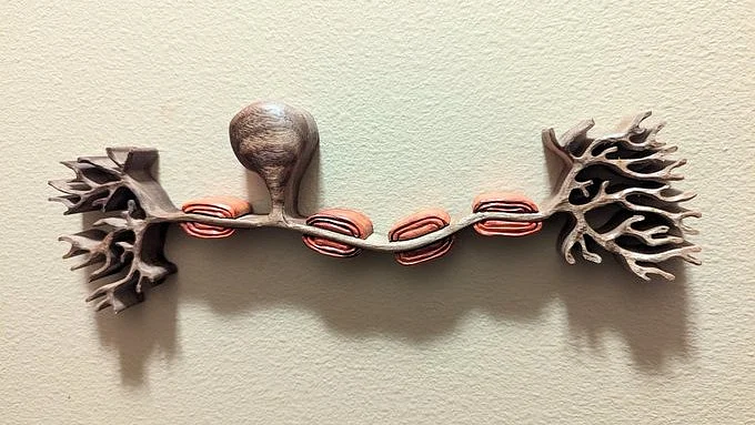 Model of a nerve cell shows clumps of myelin cushioning the neuron