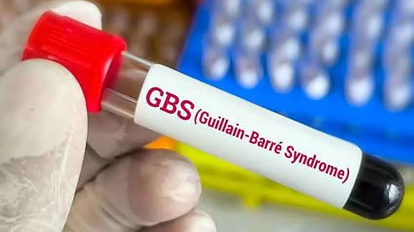 Root of Guillain-Barre syndrome outbreak (representative image) in Maharashtra yet to be traced