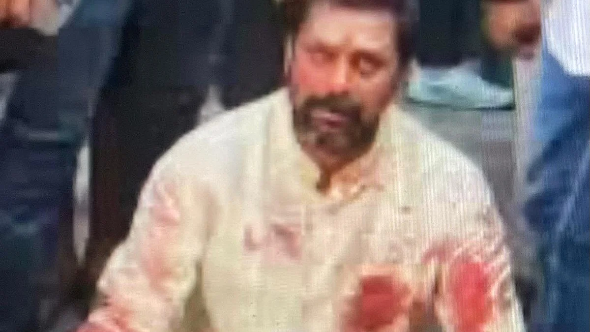 Harish Mishra in the clothes he was allegedly attacked in