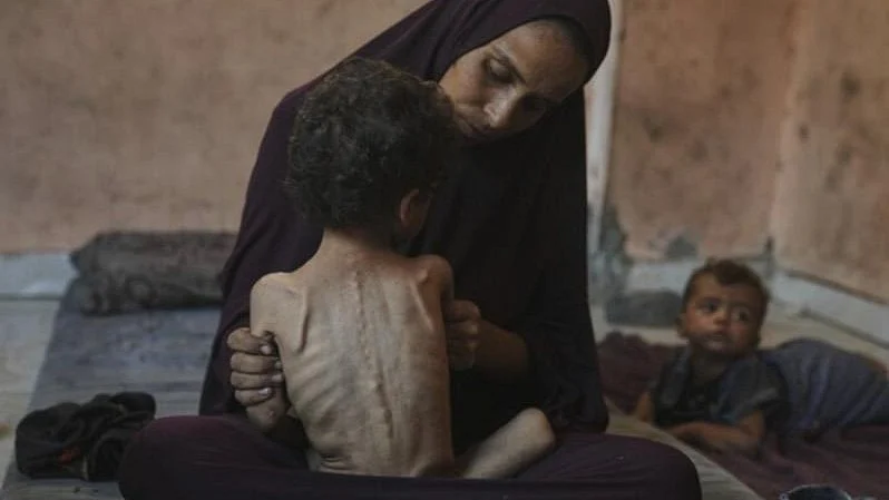 Gazans being systematically starved (representative image)