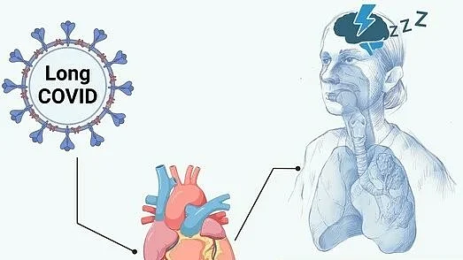 Researchers have also found 'long Covid' is more prevalent in women