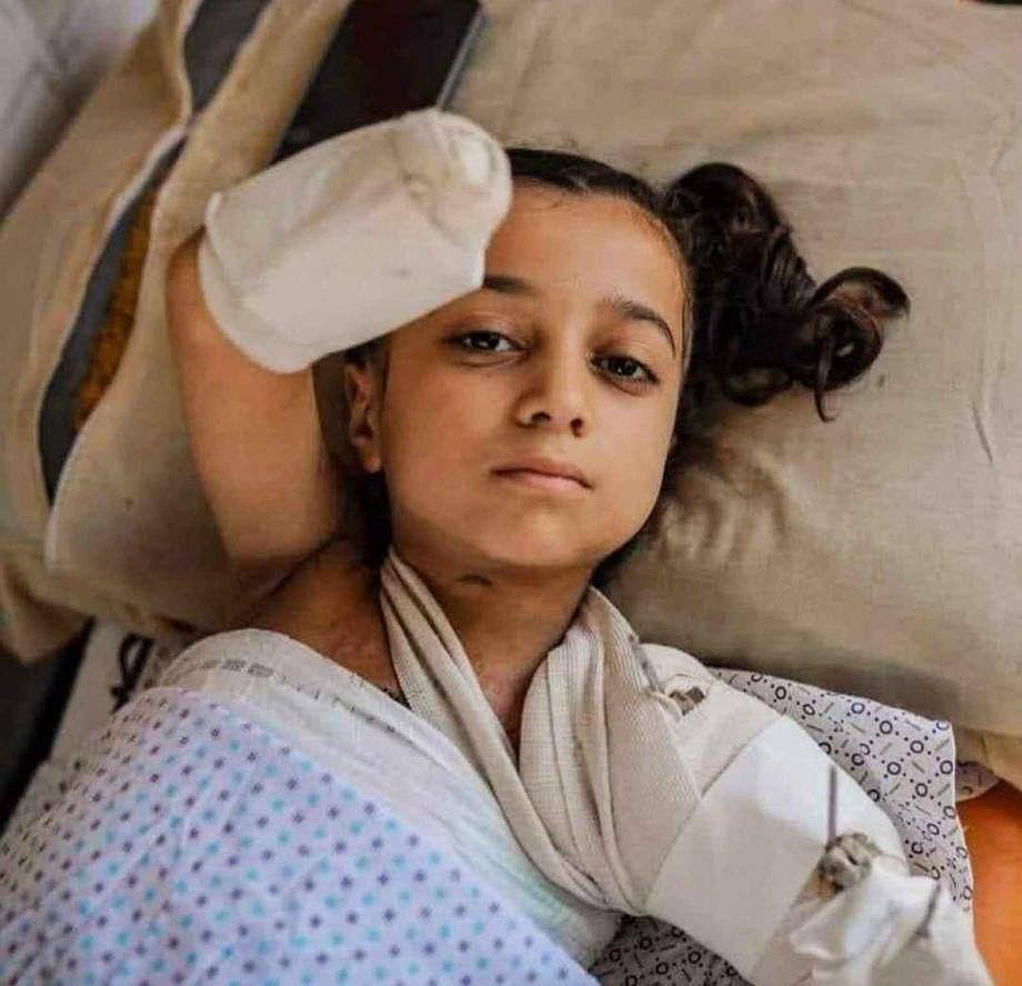 One of the 21,000-plus children of Gaza maimed by Israel’s ongoing ‘war on Hamas’