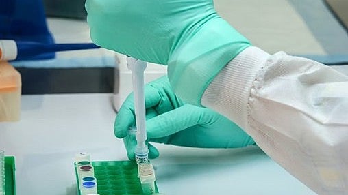 Representative image