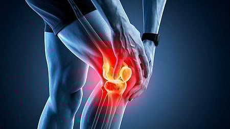 Representative image.