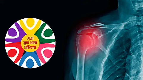 amravati bphu centres tb test kit shortage truenat