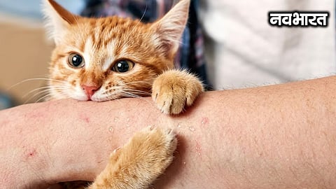 Questions raised about anti-rabies treatment and referral system in Mumbai BMC hospitals