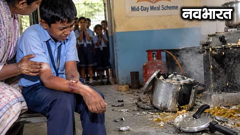 Nalasopara student scalded by pressure cooker explosion; left waiting 24 hours for treatment