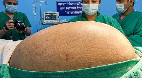 Mumbai Hospital Tumor Surgery Medical News