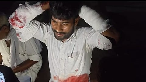 bahraich nawabganj brother in law attacks sala 