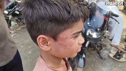 10-year-old Faizan allegedly tied to a tree and beaten in Guna forest