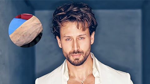 Tiger Shroff Injured Hand Video