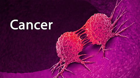 cancer
