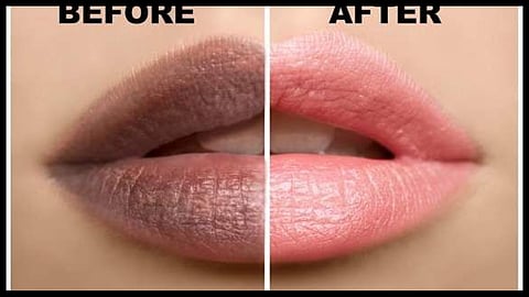 lips