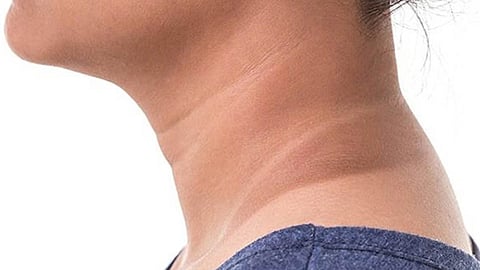 Darkened Neck