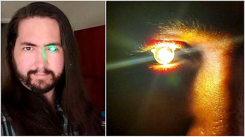 Flash Light Inside the Eyes