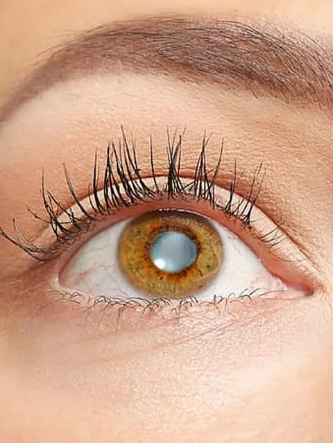 If-you-want-to-avoid-cataract,-then-take-special-care-of-these-things
