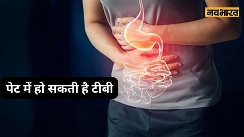 Abdominal TB