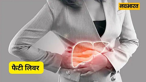 Fatty Liver, Health, Lifestyle
