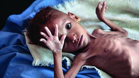 Malnutrition In Nagpur