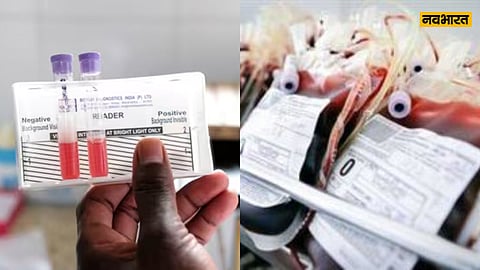 JHARKHAND, SICKLE CELL ANEMIA