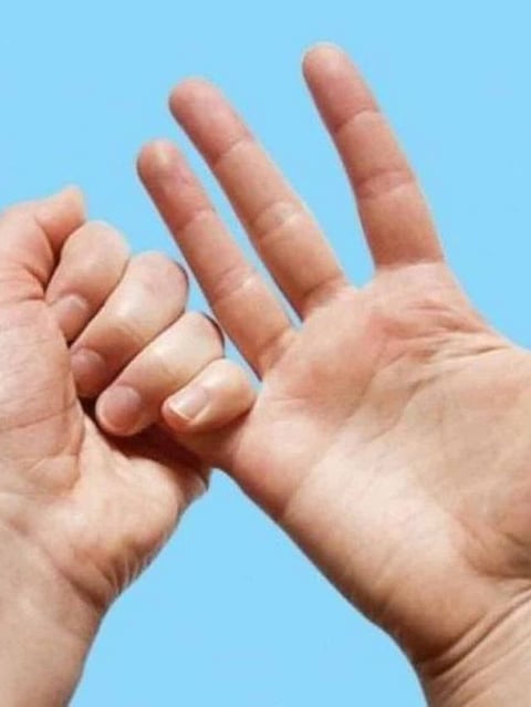 Finger (5)