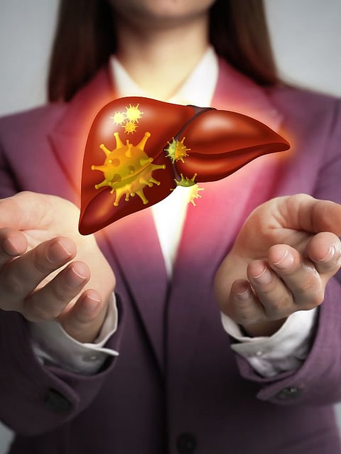 fatty liver problem