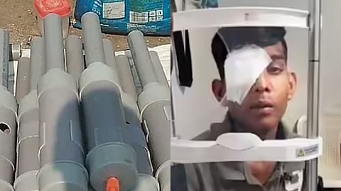 Carbide Guns Harming Eyes: दिवाली के वक्त पटाखों के तौर पर कार्बाइड गन का इस्तेमाल करने और उससे होने वाली दुर्घटना के 3 मामले सामने आए हैं।