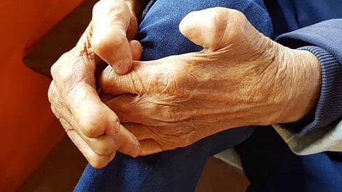 कुष्ठ रोग 'सूचनीय रोग' घोषित