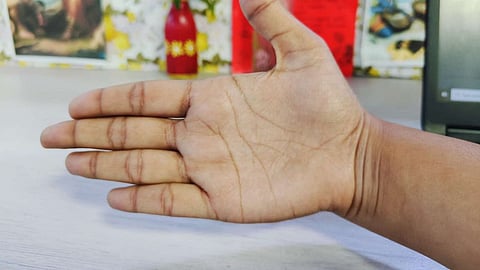 अगर हस्तरेखाओं में बना हो ये चिन्ह, तो अमीर बनने के हैं जबरदस्त योग!