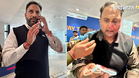 pilot attacked passenger at igi airport