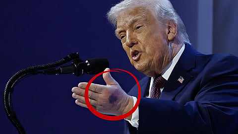 Trump's handshake in Davos raised eyebrows, and after the photo went viral, the president himself revealed the truth.