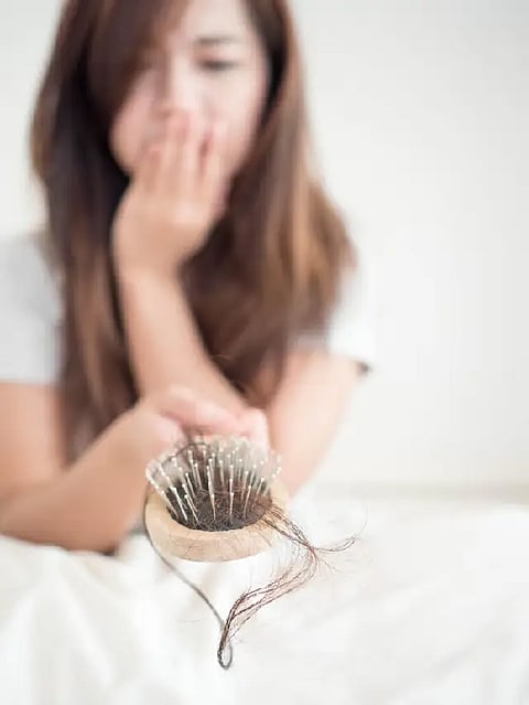 hairfall after pregnancy