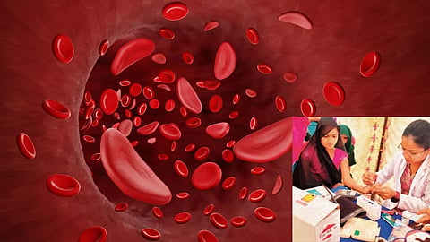 'Arunodaya' special screening campaign for sickle cell prevention launched in Nashik; the screening drive will run from January 15 to February 7.