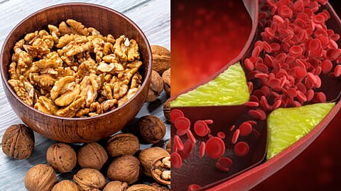 walnuts for cholesterol