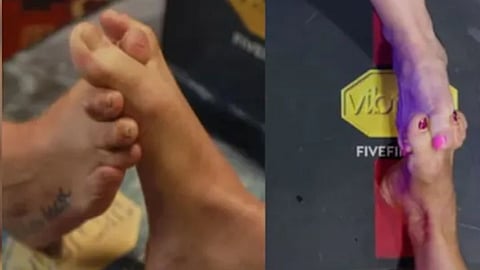 Toe Wrestling Championship in the UK is a unique sport where players compete using their toes instead of hands.