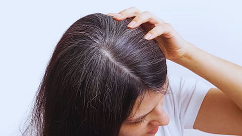 gray hair reason