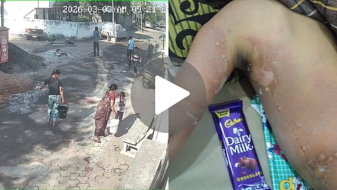 Shocking incident in Koradi, Nagpur: Grandmother pours boiling water on 5-year-old grandson for playing with pichkari. Child hospitalized; investigation underway.