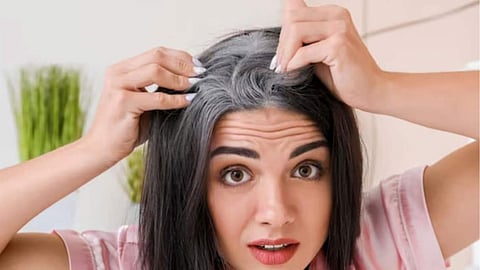 Premature Hair Greying