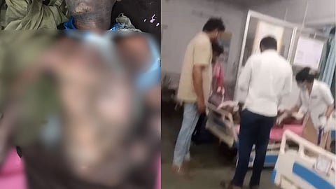 Major Accident at Logistics Warehouse in Kalmeshwar, Nagpur District: 3 Workers Injured by Electric Shock; Two in Critical Condition