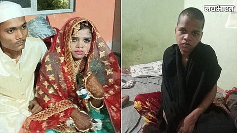 A shocking case of dowry torture reported in Kalyan, where a pregnant woman was starved, burnt, and had her head shaved by in-laws. Police booked 4 people.
