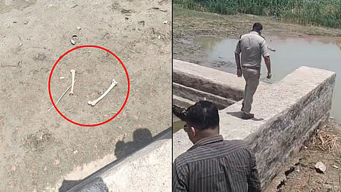 A one-year-old missing person case in Datia has taken a major turn after a human skeleton was discovered in a field