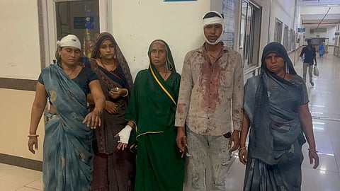 उज्जैन में बड़े पापा के परिवार ने सगे भाई-बहन पर किया लाठी-से जानलेवा हमला, एक ही परिवार के 6 लोग घायल