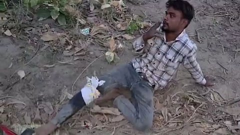 An injured criminal surprised everyone by asking police for a cigarette after being shot during an encounter in Muzaffarnagar.