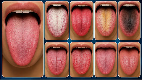 Is your tongue sounding an alarm? These 8 changes could signal a serious illness.