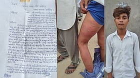 अलीगढ़ में गुरु बना गुनहगार; प्रधानाचार्य पर मासूम की बेरहमी से पिटाई का आरोप, शरीर पर उभरे चोट के निशान