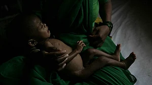 भारत में तेजी से बढ़ रहा है कुपोषण का खतरा