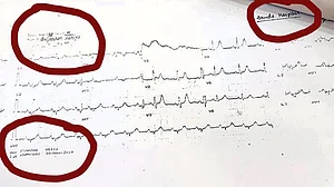 इंडियन एक्सप्रेस की ‘जांच’ रिपोर्ट के बाद जज लोया की मौत का रहस्य गहराया