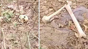 मुजफ्फरपुर में अस्पताल के पीछे मिले कई मानव कंकाल,  इसी अस्पताल में चमकी बुखार से 108 बच्चों की गई जान