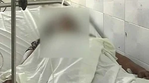 यूपी: योगी राज में नहीं बदले हालात, अब मुजफ्फरनगर में घर में घुसकर रेप पीड़िता पर आरोपियों ने फेंका तेजाब